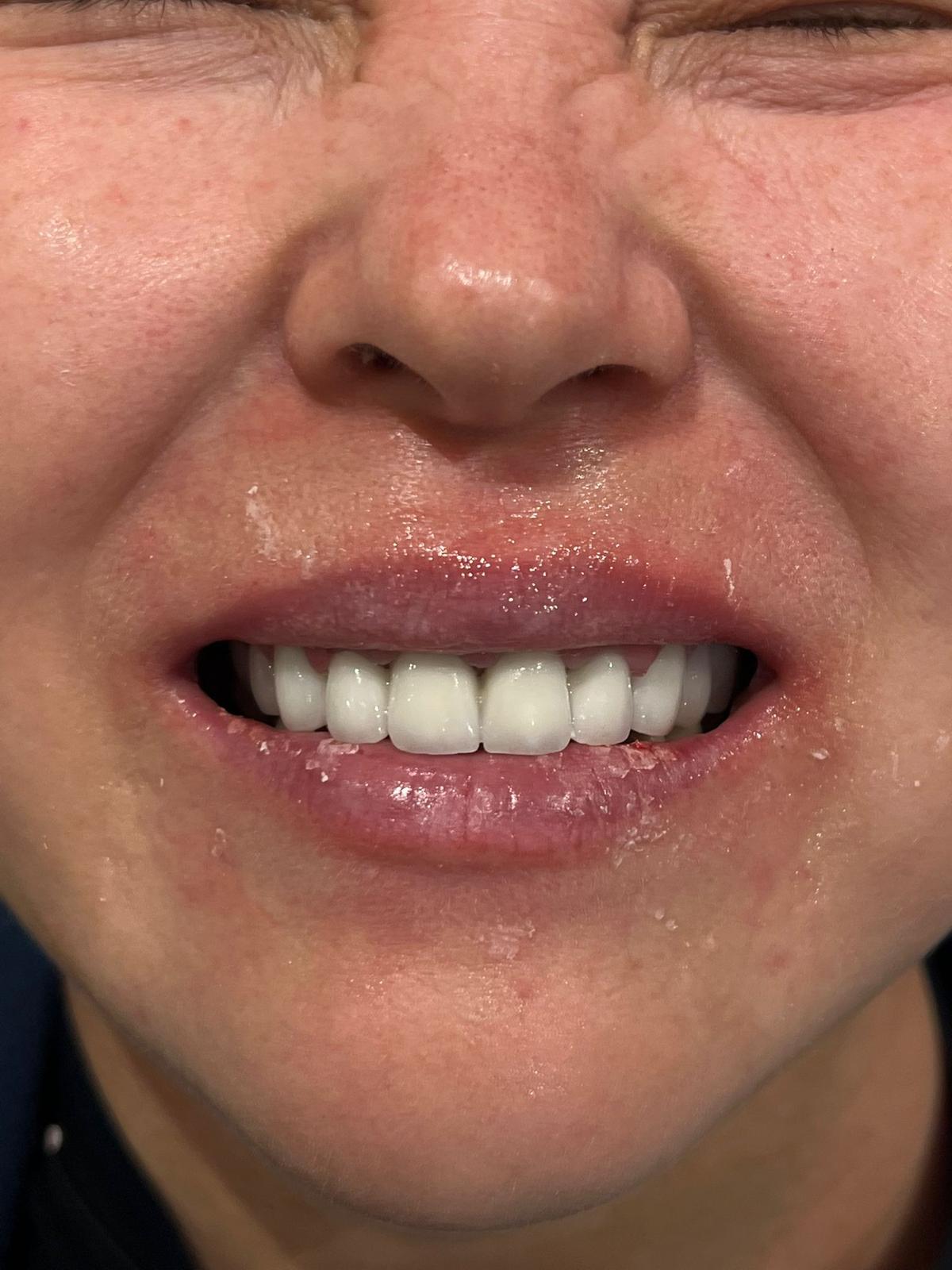 ECE Dental Patient Transformation